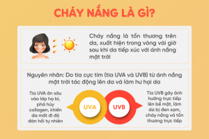 Da Bị Cháy Nắng Phải Làm Sao? 5 Bước Cấp Cứu Da Ngay Lập Tức Tại Nhà